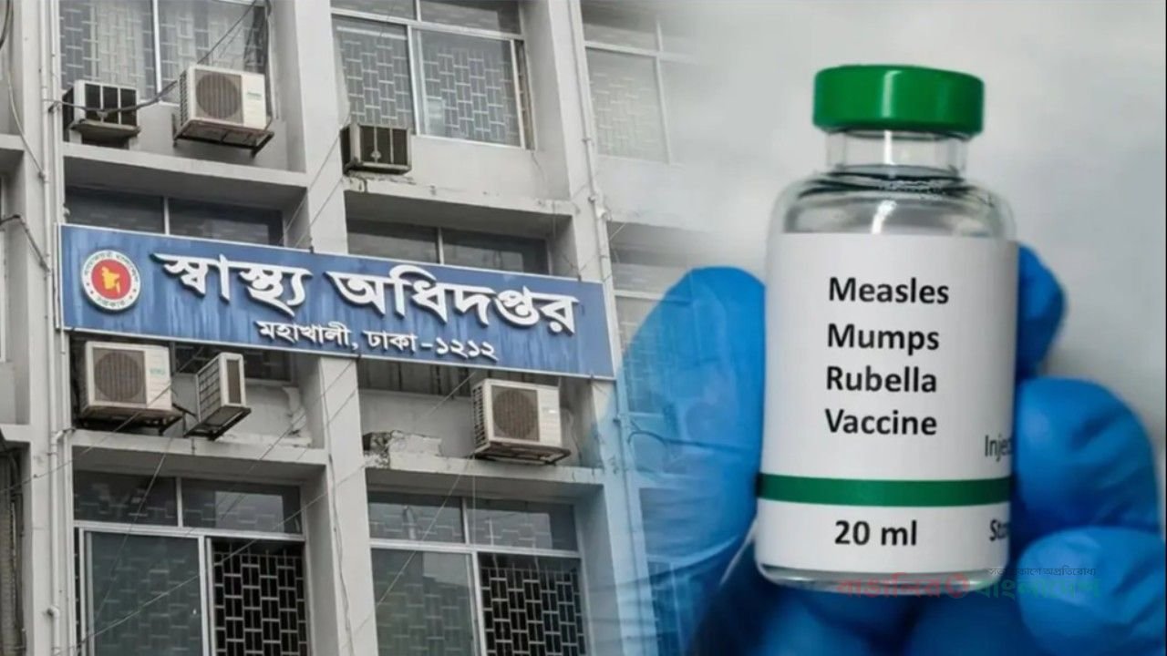 হামের উপসর্গ নিয়ে আরও ৬ জনের মৃত্যু, আক্রান্ত ১২৯৫